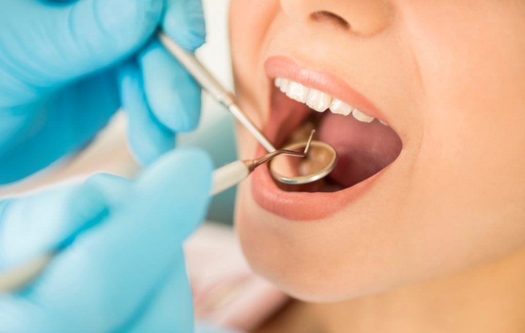 benefits Dental Charting