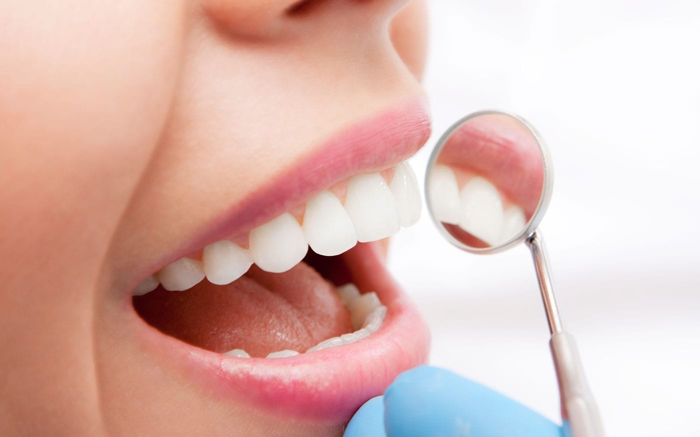 7 Types of Cosmetic Dentistry