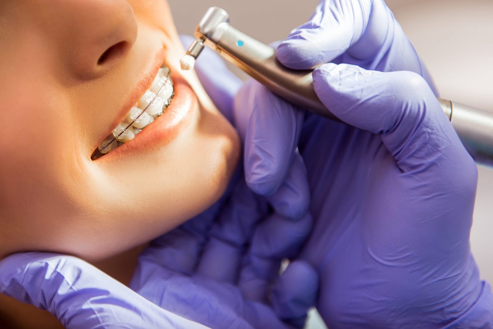 Orthodontic Treatments in North York