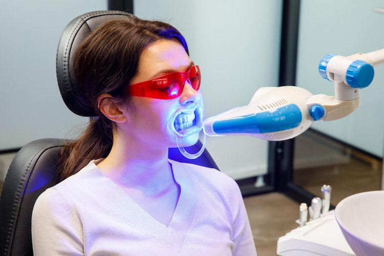 a patient is receiving teeth whitening treatment to remove amoxicillin stains from teeth in a dental office. 