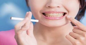 Teeth Whitening for Smokers: What Is the most effective option?