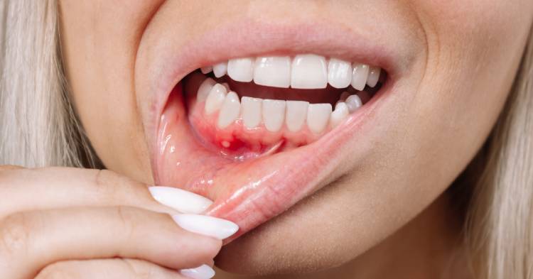 All you need to know about infection after dental work