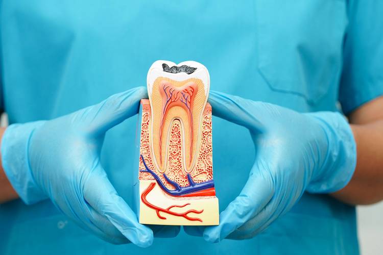 Tips about root canal pain relief 