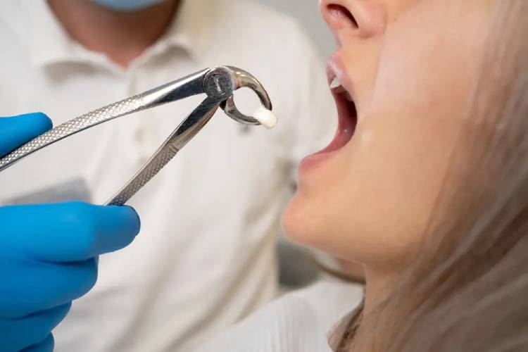 Do you have sore mouth extraction? here is a full guide
