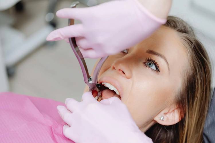 All about tooth extraction healing time