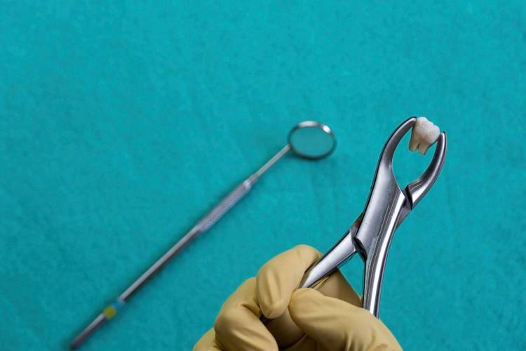 Sore mouth extraction; all you should know