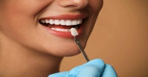 All about Celebrity veneers