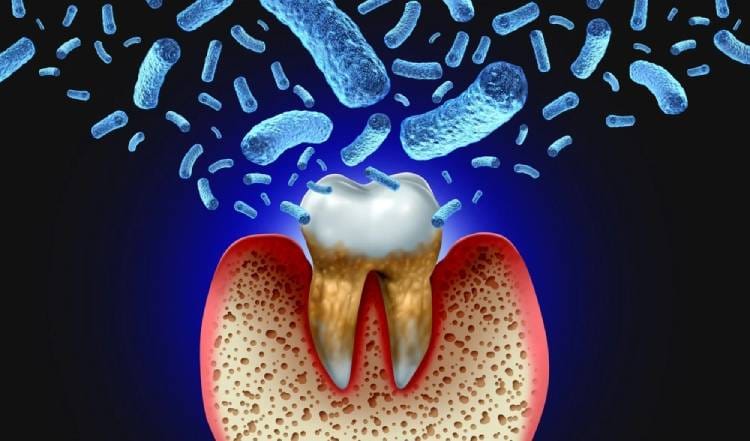 Signs that a tooth infection is spreading