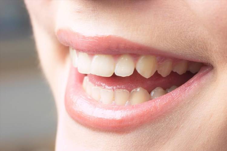 why do my teeth feel sticky