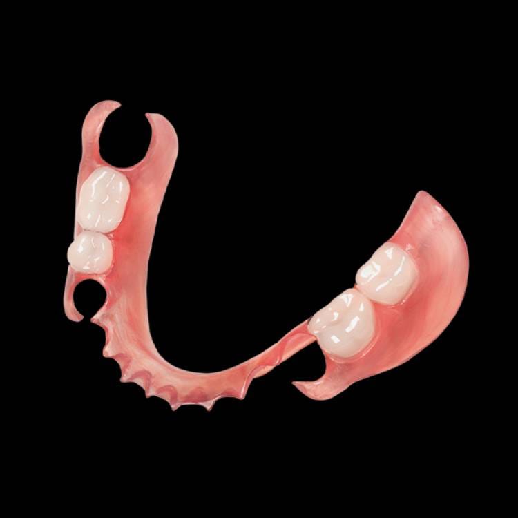Flexible partial dentures for upper teeth