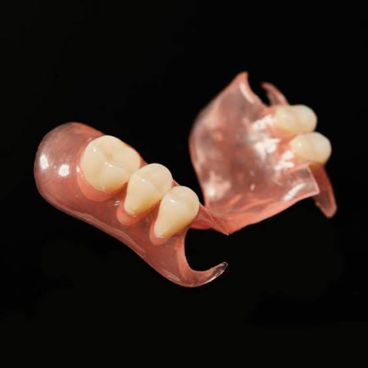 Flexible partial dentures for upper teeth