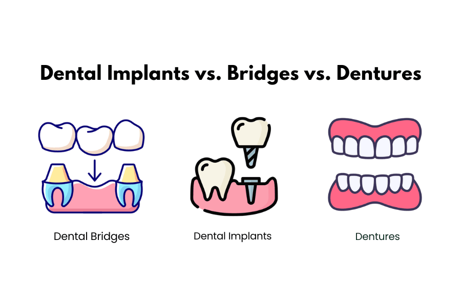 How to Replace a Missing Tooth: Best Options for a Complete Smile