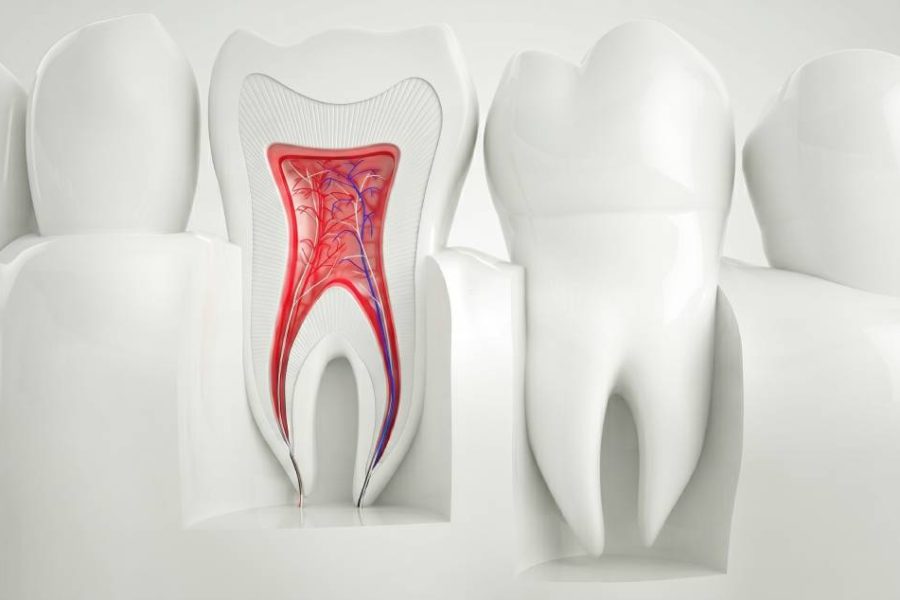 Root canal side effects; full guide